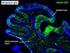 Glia-neuron interakció aspektusai. Neuron-glia metabolikus együttműködés