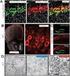 FLEX Monoclonal Rabbit Anti-Human Estrogen Receptor α Clone EP1 Használatra kész (Dako Autostainer/Autostainer Plus) Kód: IS084. Javasolt alkalmazás