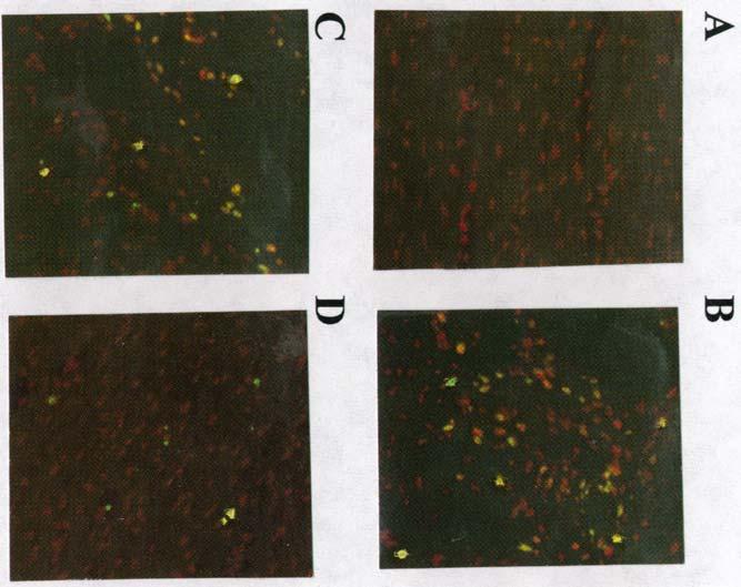 5. táblázat: Szívfunkciók különböz kaszpáz inhibitorokkal kezelt iszkémiás/reperfundált szívekben koncentráció Iszkémia el tt 60 perc Reperfúziót követ en 120 perc reperfúziót követ en Csoport µm/l