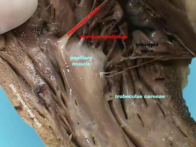 VENTRICULUS DEXTER JOBB KAMRA PAPILLÁRIS IZMAI: humán 1. m. papillaris subarteriosus 2. m. papillaris magnus 3. mm. papillari parvi 4. Sertés: mm.