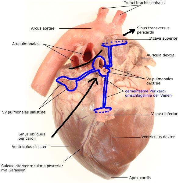 PERICARDIUM ÁTHAJLÁSA SINUS OBLIQUUS PERICARDII: vv.