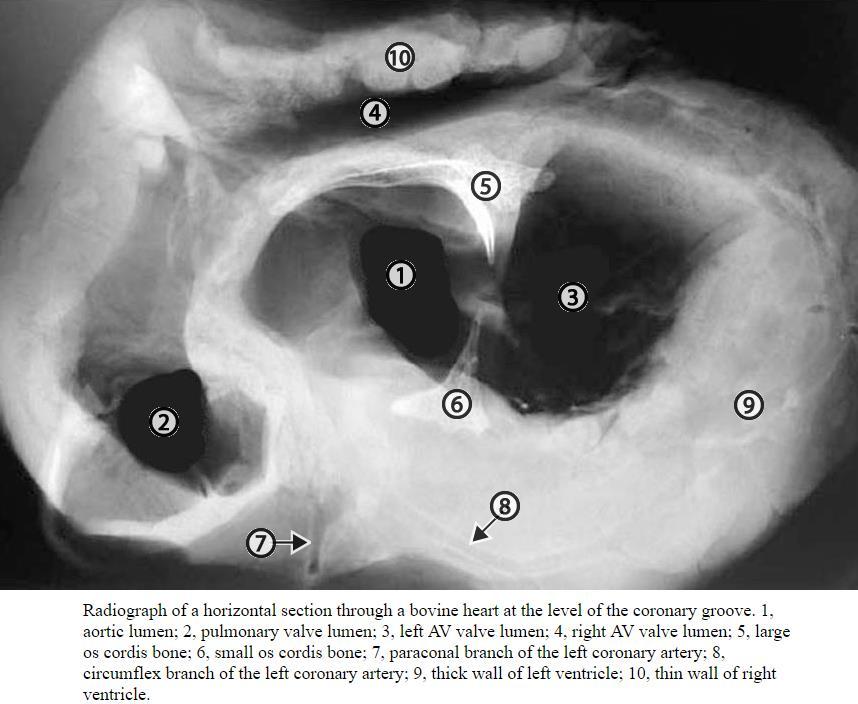 ANULUS FIBROSUS CHARTILAGO CORDIS: - két