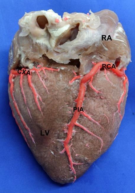 Brazilian Journal of Cardiovascular Surgery Print version ISSN 0102-7638 Rev Bras Cir Cardiovasc vol.29 no.2 São José do Rio Preto Apr.