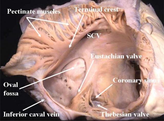 pitvarba hátsó felszínen, sulcus coronariusban ostium sinus coronarii - valvula sinus