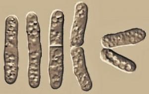 Élesztőgombák Schizosaccharomyces pombe Sejtjei