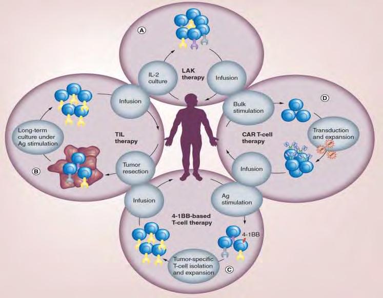 Adoptiv immunterápia Adoptiv immunterápia: páciens T sejtjeinek ex vivo manipulációja, tumor specifikusság fokozására: A.