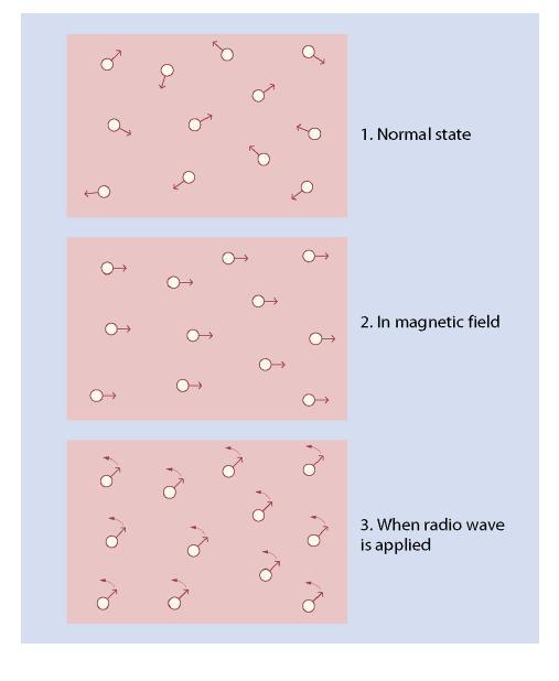 Alapelv Stabil mágneses mező Rádiófrekvenciás jel be- majd