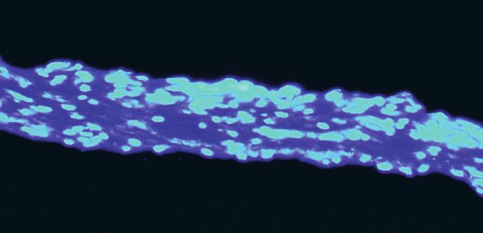 during healing 11 TIME Images show DAPI (a florescent stain, diamidino phenylindole) stained Endoform