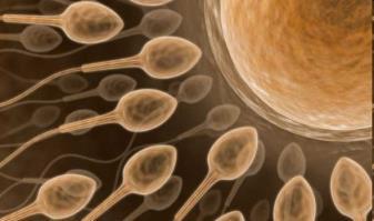 Spermatogenesis eredménye: Leválás a Sertoli-sejtről Plazmahidak megszűnése Herecsatornácska rete testis (myoid sejtek, herét burkoló simaizom) Farok Mellékhere
