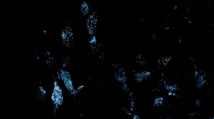 Retrograde labelling of neurosecretory cells FLUORO-GOLD labelling