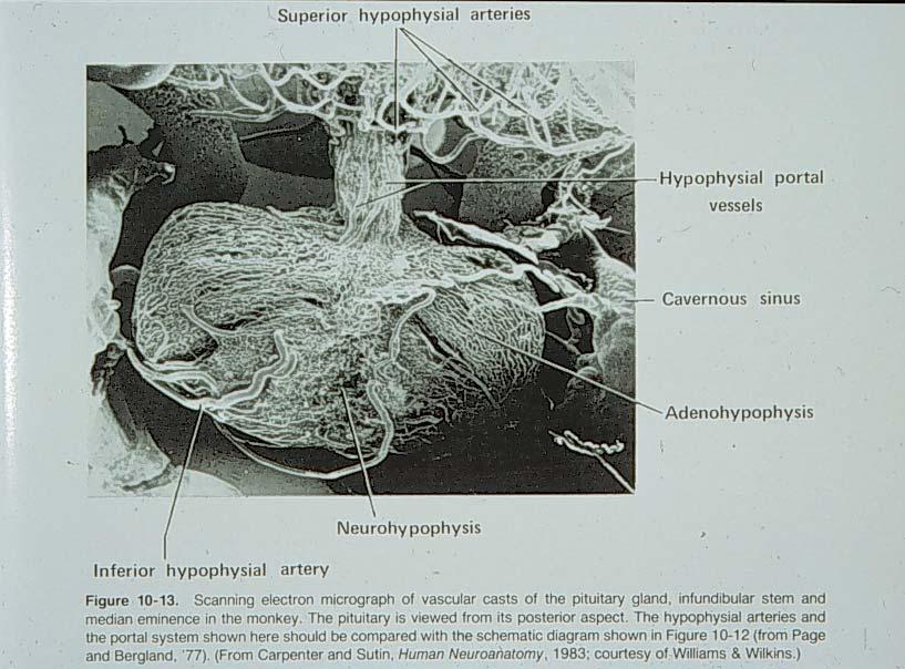 N E U R A L STALK NEUROHYPOPHYSIS HYPOTHALAMUS SHA PV V A S C U L A R A