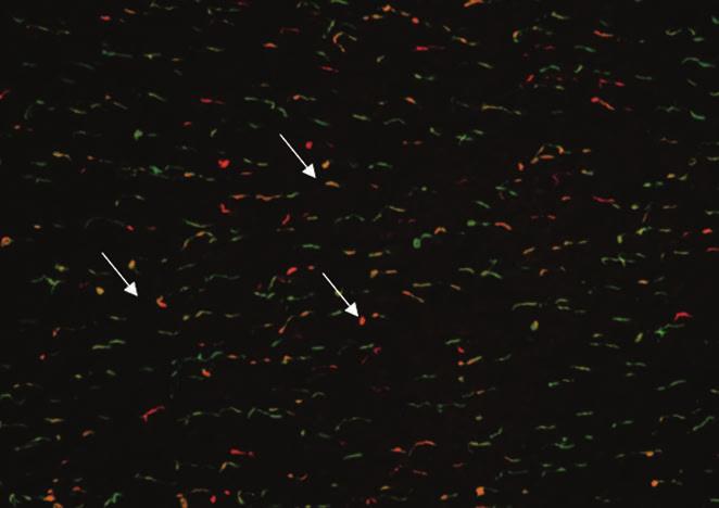 Fotoreceptorok fejlődése emlősökben sökben nem különíthetőek el egymástól immuncitokémiailag a vörös és zöld csapok. A molekuláris biológiai technikák (pl.