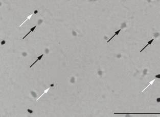 A receptor hiányában a zöld-pigment termelése nem indul be, az összes csap megreked a korábbi, csak S-pigmentet tartalmazó stádiumban.