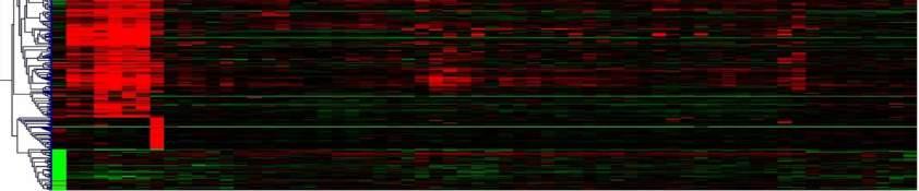 A papilláris vese tumorok eredetéről tartott eltérő vélemények A specifikus kromoszóma/dns/gén elváltozások