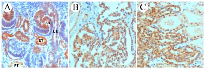 differenciálódó disztális tubulusokban volt erős immun-reakció, míg a proximális tubulusok és Henle kacs sejtjei csak gyenge sejtmag pozitivitást mutattak (17. ábra A).