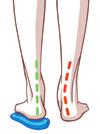 POSITION - SCHOLL BIOMECHANICS Enyhíti a túlzott pronáció hatásait POSITION - REMOVABLE INSOLE Scholl a lehető legkényelmesebb lábbelik a lábbal