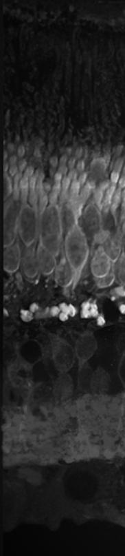 FOTOTRANSZDUKCIÓ A retina sejttípusai Retinális epithelium A fény iránya Fotoreceptorok Horizontális sejtek Bipoláris sejtek Amacrine