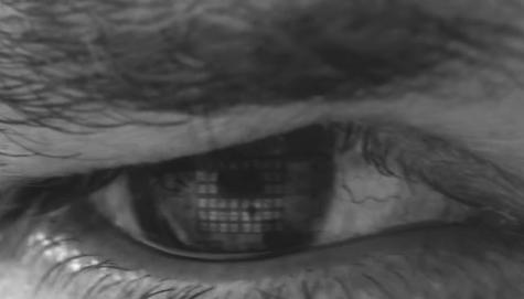 Vision Care) Intraoculáris nyomás monitorozása: glaucoma esetén Arch Ophthalmol.