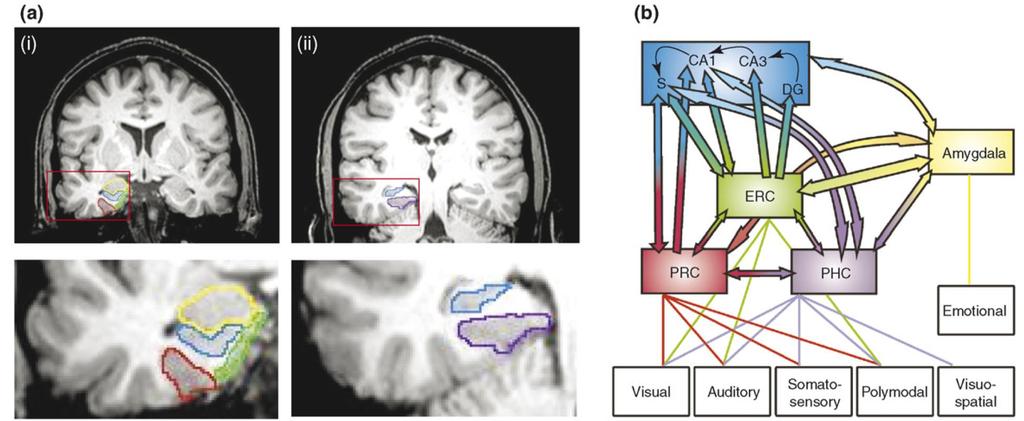 Az explicit (deklaratív) memória: struktúra Medialis temporalis régió ERC entorhinalis cortex