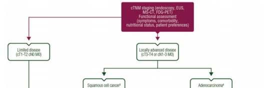ct1-t2 cn0 M0 EMR, ESD v.s. oesophagectomia Preop.CRT.n=195,R0 rátát nem javította ESMO Clinical Practice Guidelines for diagnosis, treatment and follow-up F.
