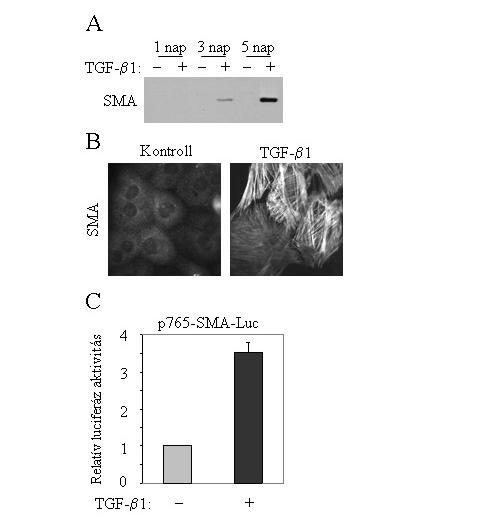 10. ábra Az EMT a TGF-β1 de novo simaizom típusú α-aktin (SMA) expresszióját váltja ki. A: LLC-PK1 sejteket 30%-os konfluenciától vehikulummal ( ) vagy 4 ng/ml TGF-β1-gyel (+) kezeltünk.
