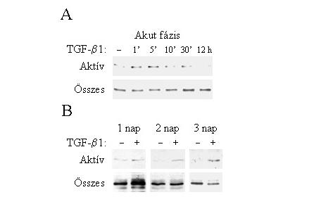IV.2 A RhoA GTP-áz részt vesz a TGF-β1 indukálta EMT irányításában A TGF-β intracelluláris jelátviteli rendszerek széles spektrumát aktiválja: közülük több is hozzájárulhat az EMT komplex