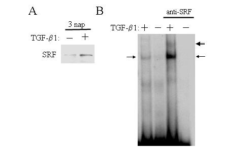 szükséges, vizsgáltuk az SRF funkcióját az EMT-ban. Az SRF indukálható fehérje, és maga is SRF-függő módon expresszálódik, ezért vizsgáltuk a mennyiségének változását.