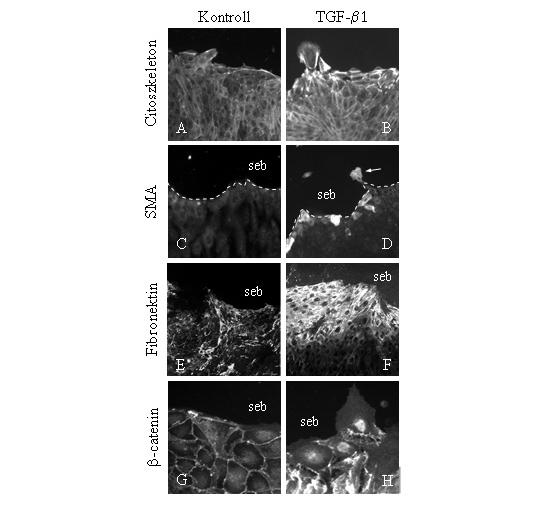 23. ábra Sebzéses modellben a sejtkontaktusok elvesztése konfluens tenyészetben is helyreállítja a TGF-β1 EMT-t indukáló hatását.