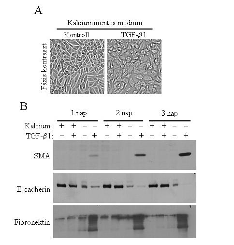 24. ábra A kalciummentes médium helyreállítja a TGF-β1 transzformáló képességet konfluens sejttenyészeten is.