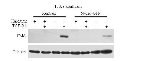 TGF-β-val kezelt sejtekben detektáltunk SMA expressziót. Azonban a SMA expresszió mértéke drámai módon csökkent az N-cad-GFP vírussal indukált sejtekben (41. ábra). 41.