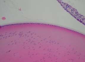 MDF Formalin