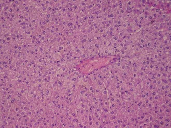 HEPATOCELLULÁRIS