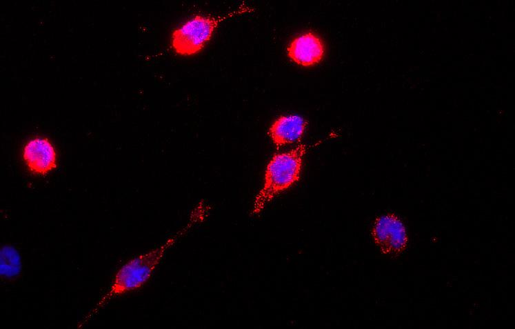 the plasma membrane. The differences between both conditions can be seen from figure 6.