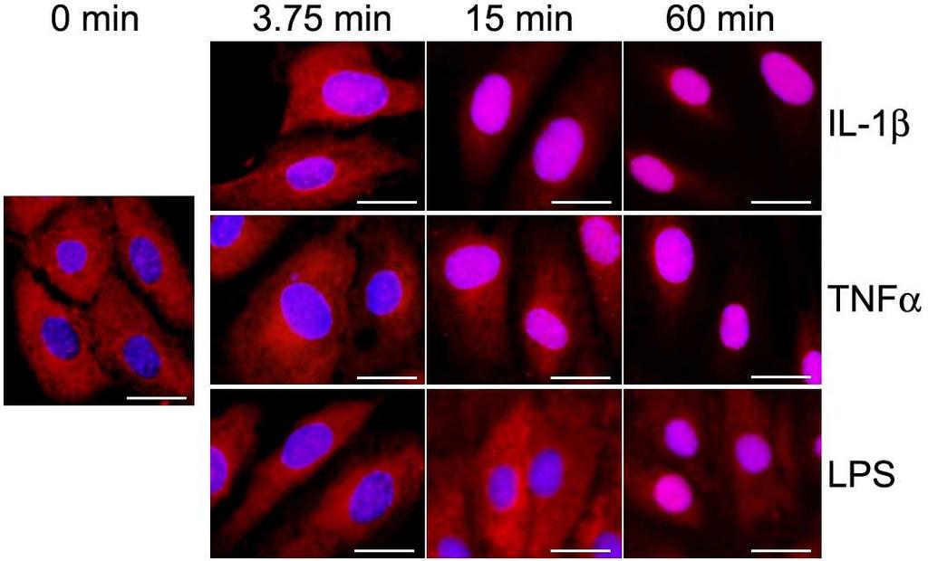 A B 13. ábra NFκB transzlokáció kinetikája. Az endotélsejteket különbözı idıtartamig 1 ng/ml IL-1β-val, 10 ng/ml TNFαval és 1 µg/ml LPS-sel kezeltük.