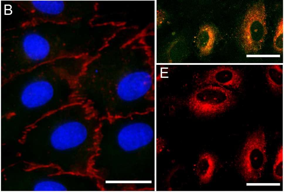 C, D, E: Golgi: zöld (C); TLR4: piros (E); kolokalizáció: sárga (D) A sejteket anti-tlr4 antitesttel, majd Alexa568-konjugált ellenanyaggal és Bodipy FL C5-ceramiddal inkubáltuk. Skálázás: 20 µm.
