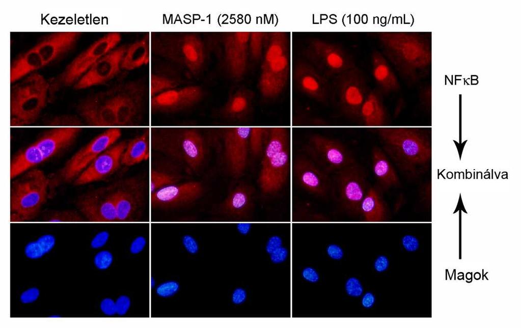 A B C 22. ábra NFκB transzlokáció MASP-1 hatására. A endotélsejteket különbözı dózisú MASP-1-gyel és LPS-sel kezeltük 1 órán át.