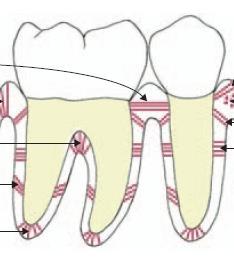 Nagyobb extrúzió cone