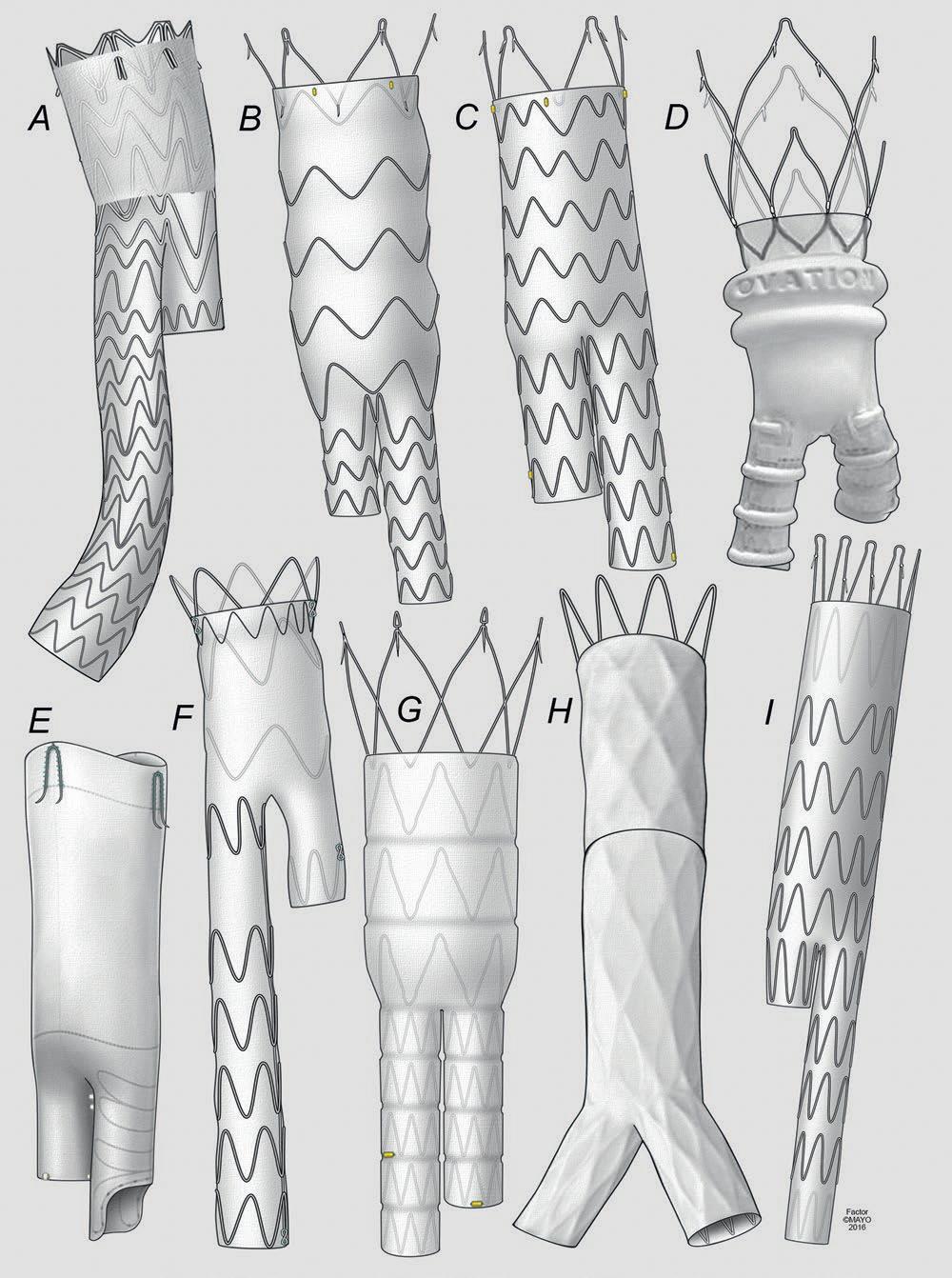 8. ábra Az abdominalis graftok leggyakoribb típusai 16 Gore Exluder (A), Bolton Treovance (B), Medtronic Endurant (C), Endologix Ovation (D), Vascutek Anaconda (E), Medtronic Talent (F), Cordis