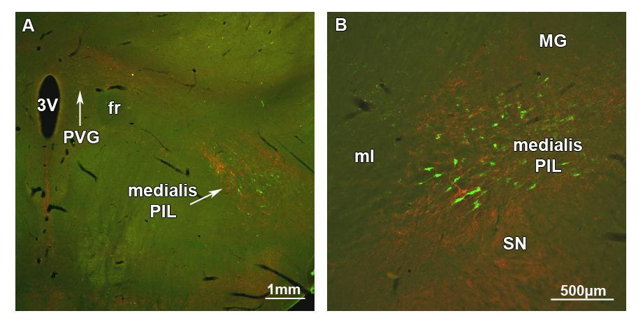 A TIP39 sejtek és a galanin rostok közötti topográfiai kapcsolat a posterior thalamusban A: A horizontális síkban a TIP39-ir neuronok (zöld) és a galanin-pozitív rostok (piros) a PIL ugyanazon részén
