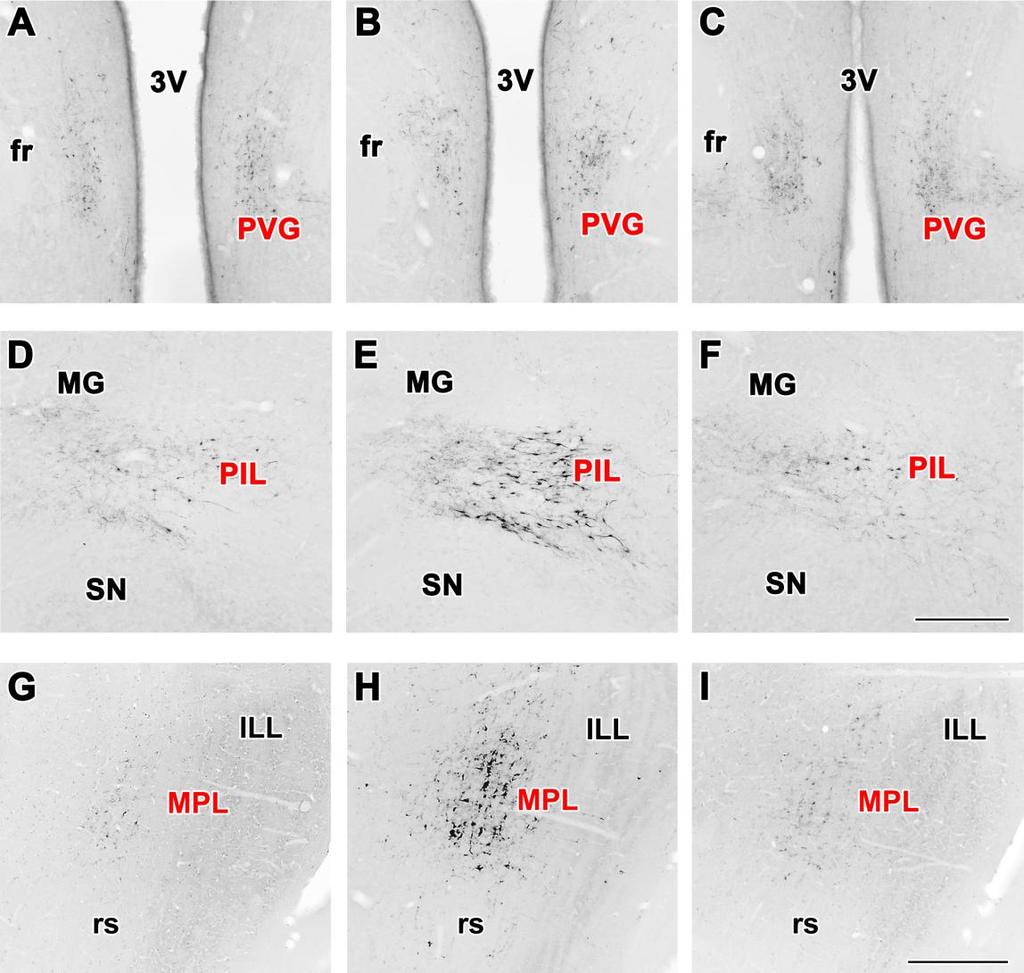 mrns-nek megfelelő szignált a laktáló anyák vizsgált agyterületein (1-10 mm caudalisan a bregma szinttől). Az autoradiográfiás jel intenzitása határozottan magasabb volt az anyaállatok MPL-jében (17H.