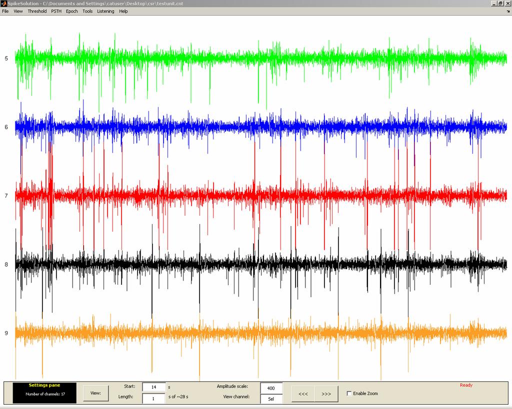 Sorted channel view: the user can choose the channels to view (fig. 11)