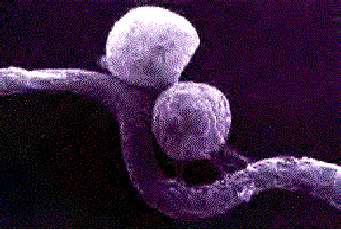 A BORRELIÁK A LYME MEGJELENÉSI FORMÁI II. 1. A LYME- 2. A LYME- MEGJELENÉSI ALAKJAI A SZERVEZETBEN I. 3. A LYME- MEGJELENÉSI ALAKJAI A SZERVEZETBEN II. Veszélyben levedlik a sejtfalköpenyüket 2.