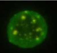 A BORRELIÁK A LYME MEGJELENÉSI FORMÁI III. A LYME 2. A LYME MEGJELENÉSI ALAKJAI A SZERVEZETBEN I.