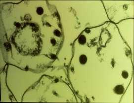 LYME 5. A KÉT BETEGSÉG KAPCSOLATÁNAK GYÖKEREI/2 1.FOGALMAK TISZTÁZÁSA: BORRELIOSIS 2.
