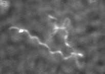 A BORRELIÁK A LYME MEGJELENÉSI FORMÁI I. 1. A LYME- 1.