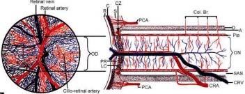 / Artéria ophthalmica (ACI 1.ága intracraniálisan) 4./ Art. Carotis Interna (ACI): ACI atheroscleroticus cholesterin lágy plakk -mikroembólizáció 5.