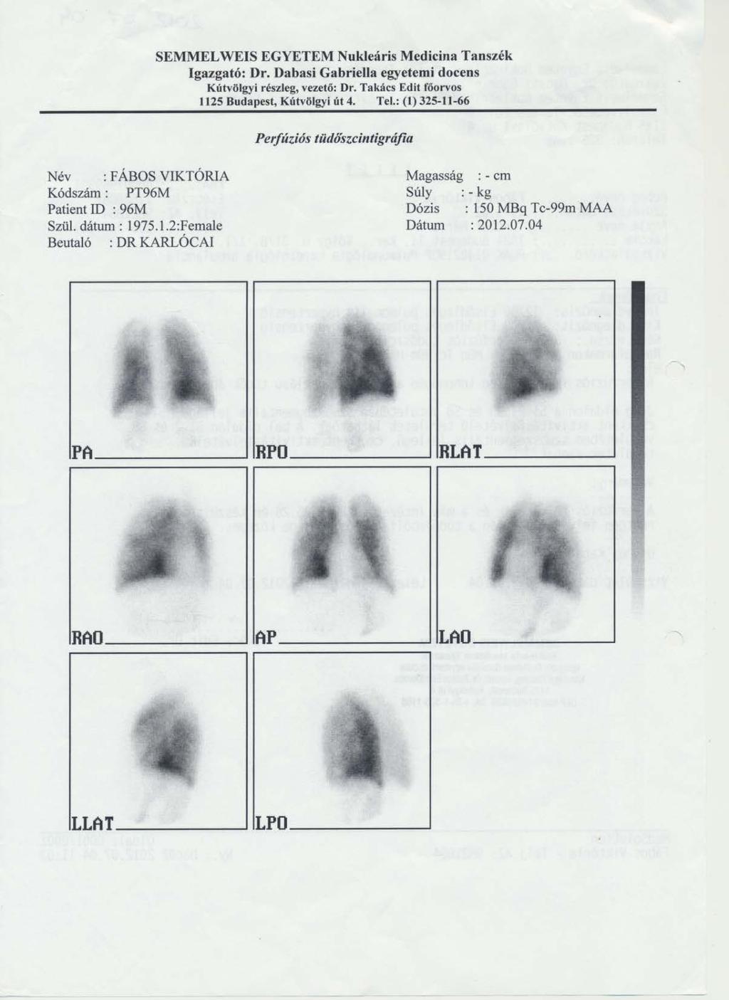 VQ scan