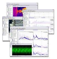 Automatikus Rezgésdiagnosztikai Szakértői (MI) Rendszer Machine Condition Assessment - Software Adatbázis építési varázsló 3Ds rezgésjelek feldolgozása, Szabály bázisú MI (mesterséges intelligencia)