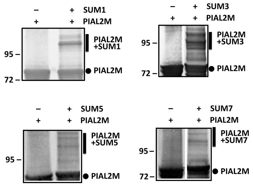 Supplemental Figure 12. Auto-sumoylation of PIAL2 M indicates interaction with SUMO1, SUM3, SUM5 and SUM7.