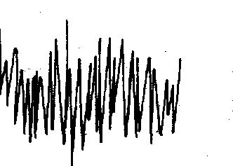 (B) A Rh-lemez (Rq ~ 0,01) elektronenergia-veszteségi spektruma.